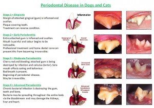 periodontal-disease